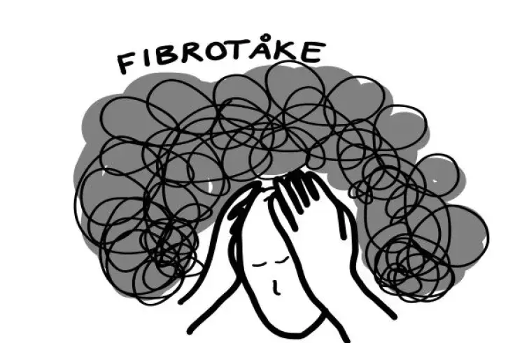 Fibromyalgi